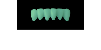 Cod.C15Facing : 10x  wax facings-bridges,  SMALL, Overlapping, TOOTH 43-33, compatible with Cod.A15Lingual,TOOTH 43-33 for long-term provisionals preparation